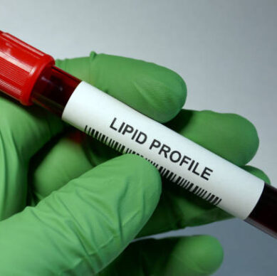 Lipid profile - laboratory analysis performed on a blood sample that is extracted from a vein in the arm using a hypodermic needle and vacutainer.